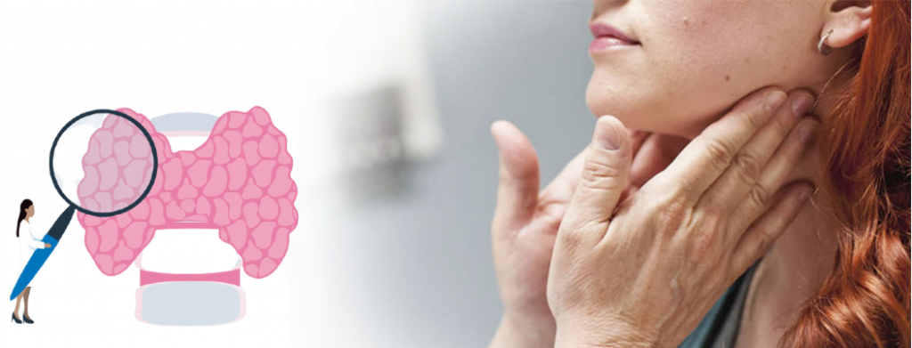 Thyroid Care