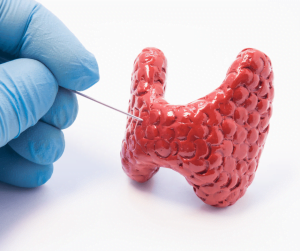 Thyroid care in Ayurveda involves a holistic approach to balance the thyroid gland's function through diet, lifestyle modifications, herbal remedies, and specific therapies, aiming to improve overall thyroid health and hormonal balance.